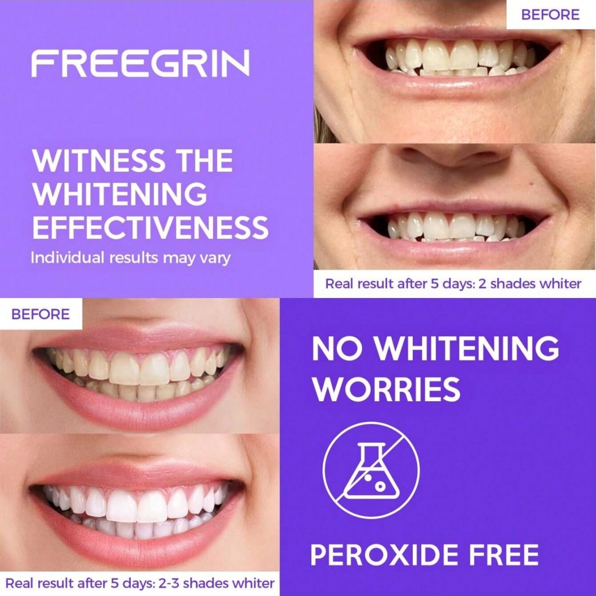 Deluxe Whitening Teeth Sticker - Home Fragrance Gel 리뷰 및 가격